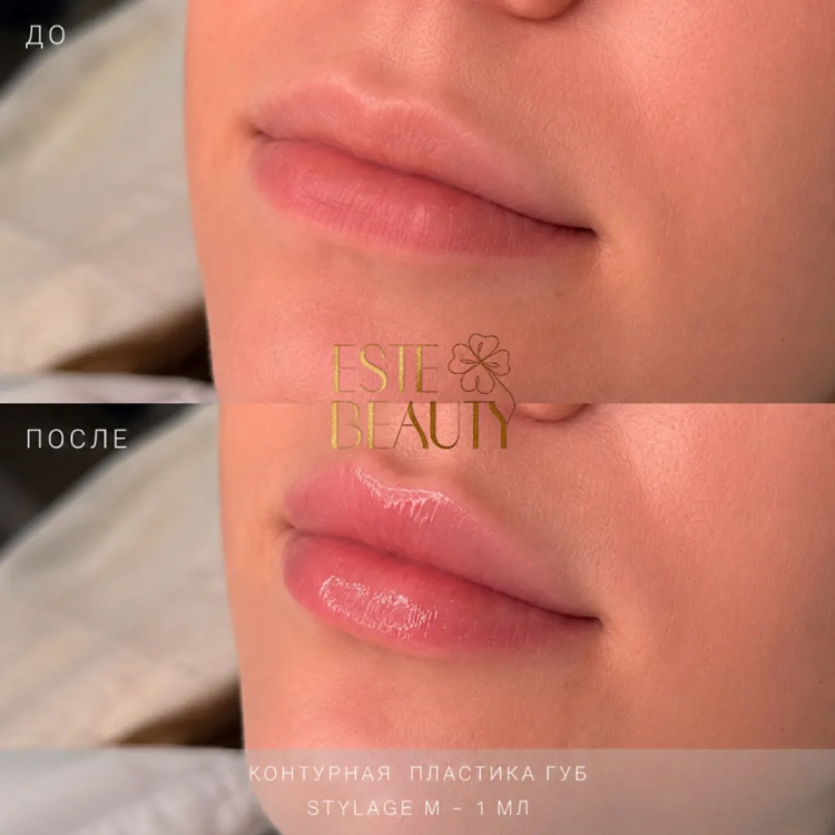 Портфолио - 1